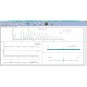 ELECTROCARDIOGRAPHE PC EDAN ECG PC SE-1010-EDA044